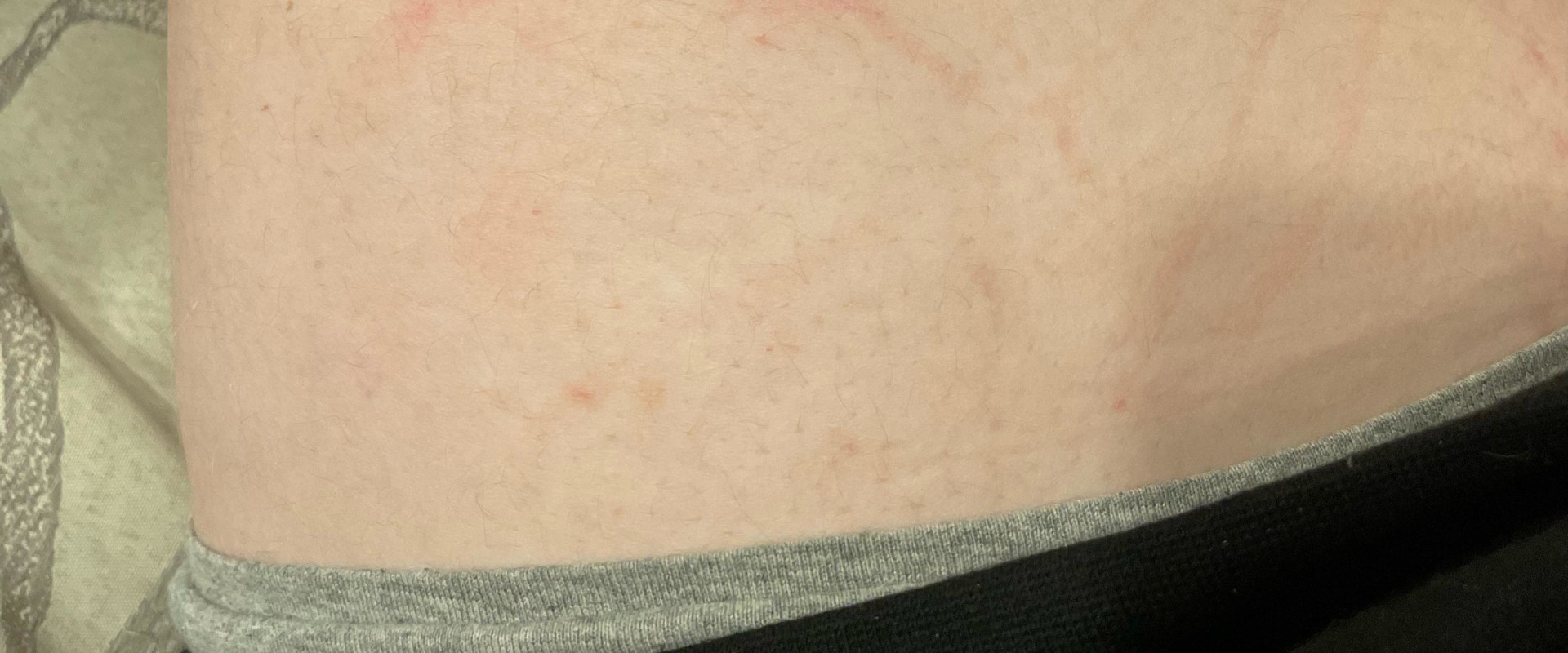 Can testosterone injections make you feel weird?