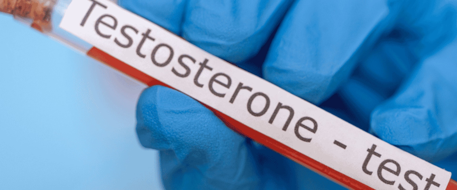 When should testosterone levels be drawn?