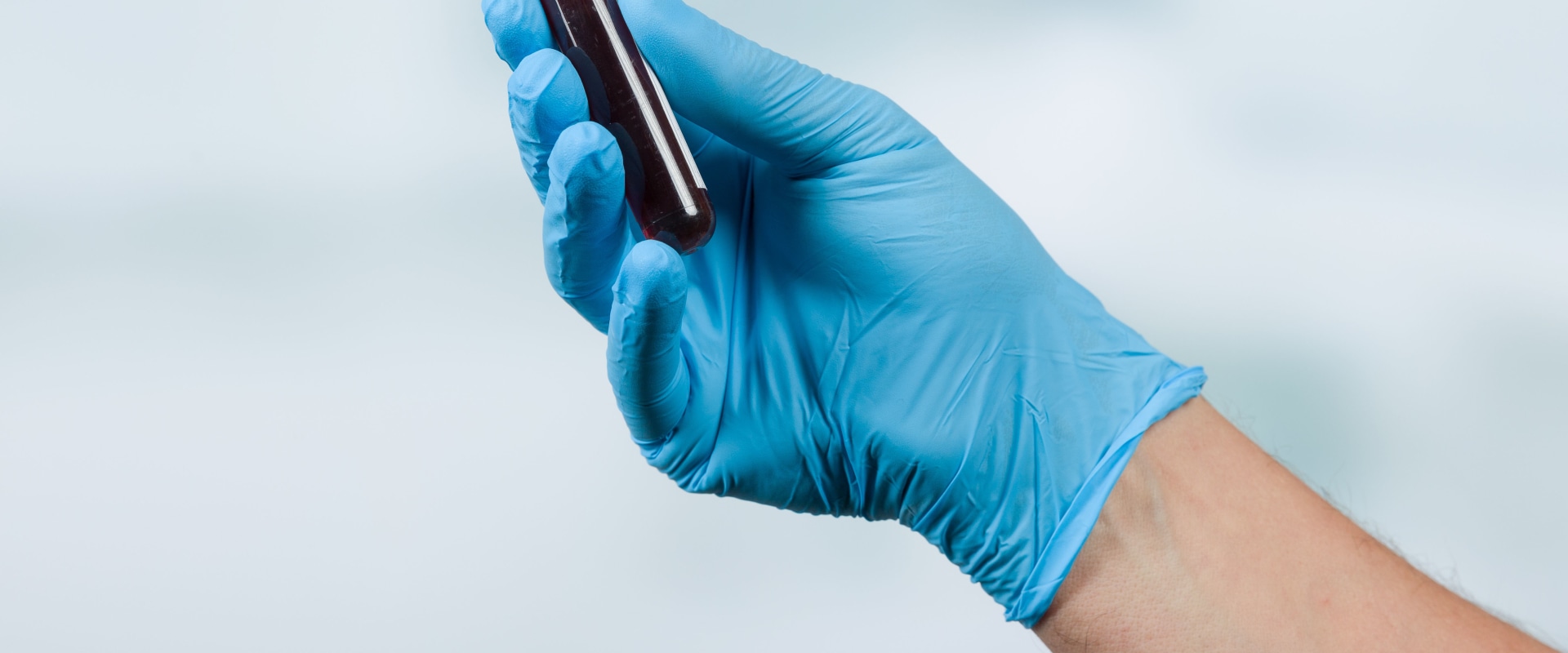 How often should you check your psa when taking testosterone?