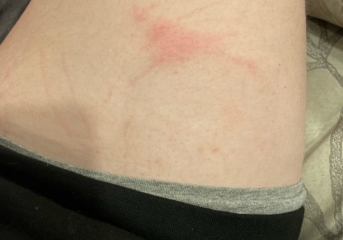 Can testosterone injections make you feel weird?